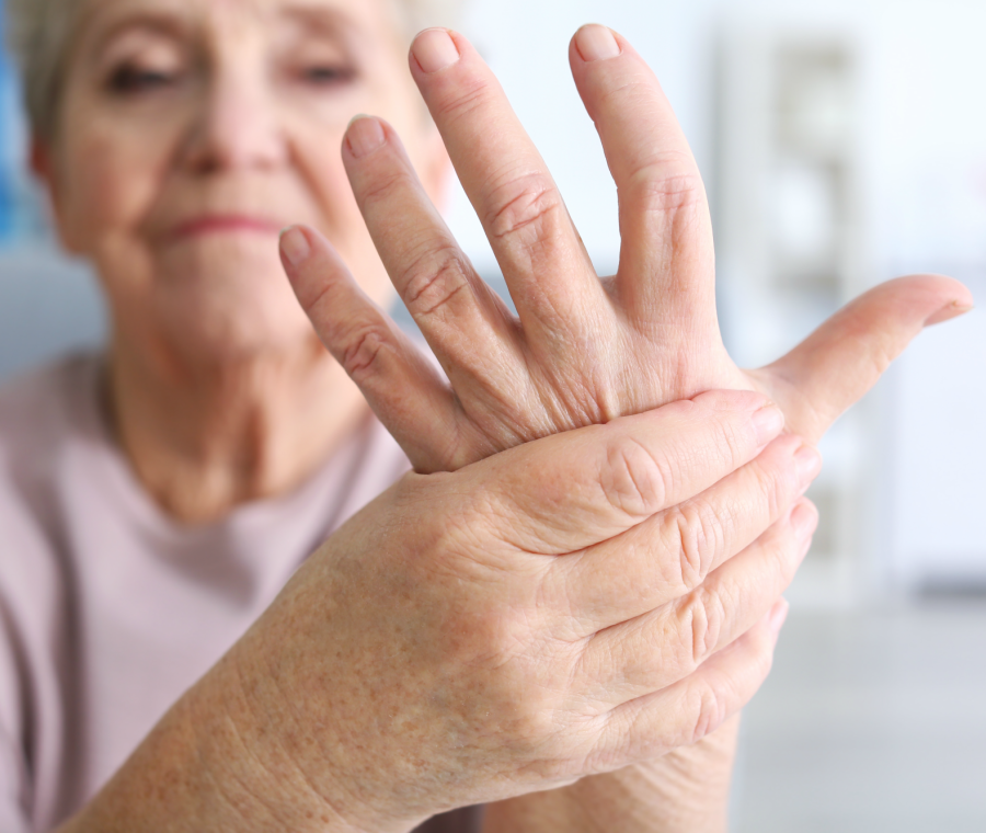 Con l’artrite reumatoide aumenta il rischio di infarto ed emorragia cerebrale